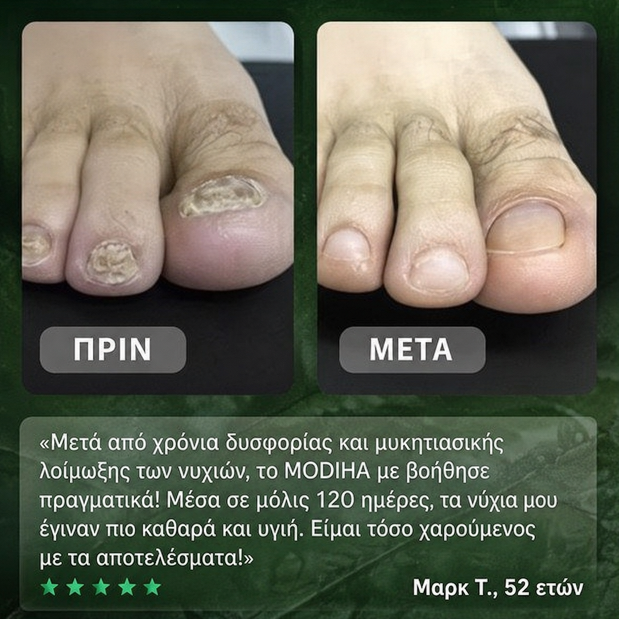 Υγιή Νύχια. Φρέσκα Πόδια. Απόλυτη Αυτοπεποίθηση