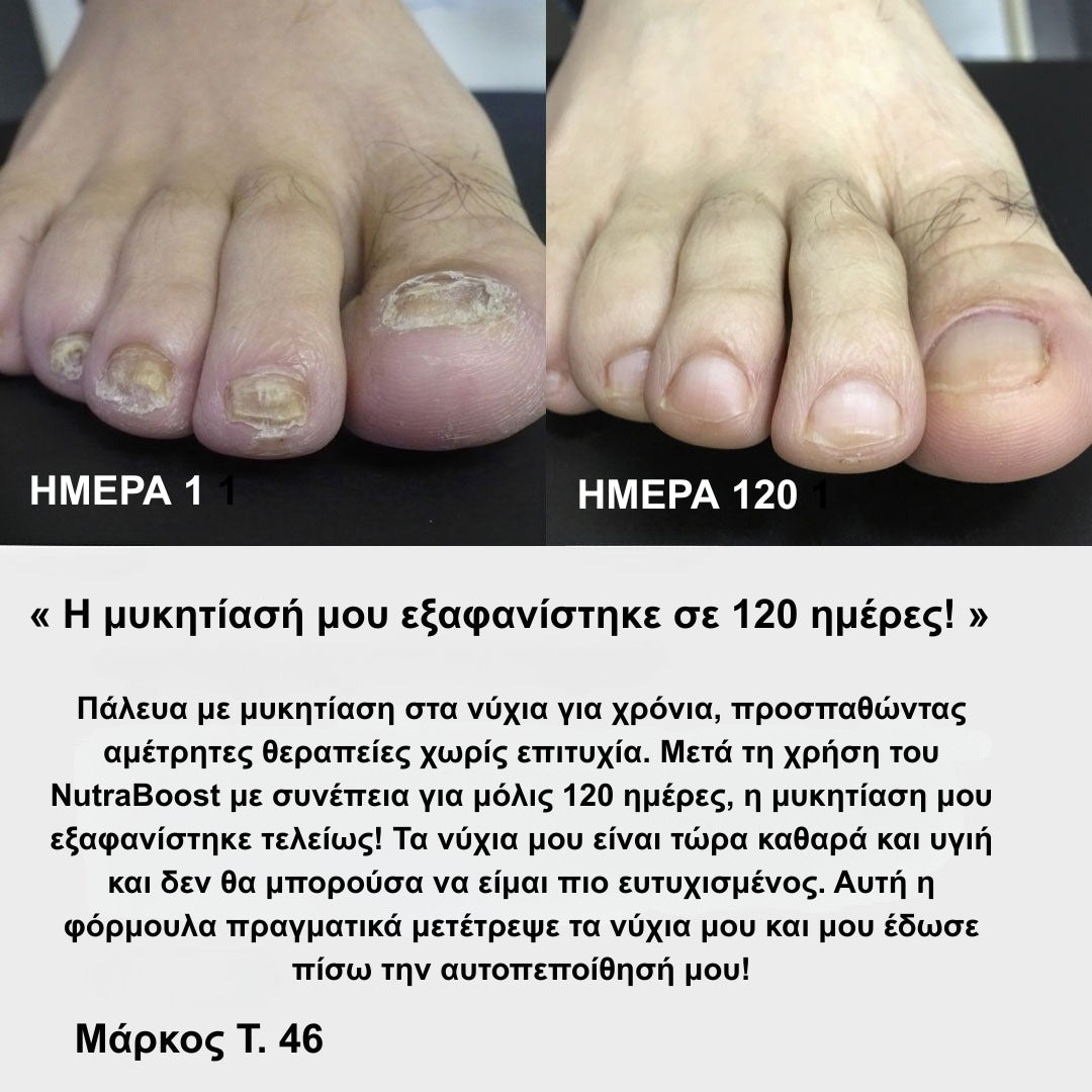 Υγιή Νύχια. Φρέσκα Πόδια. Απόλυτη Αυτοπεποίθηση