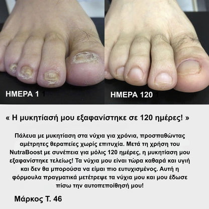 Υγιή Νύχια. Φρέσκα Πόδια. Απόλυτη Αυτοπεποίθηση